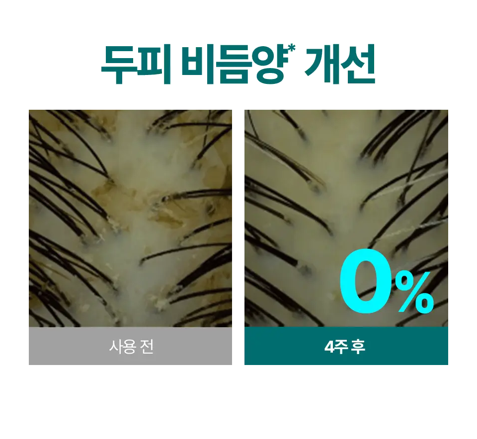 [비듬두피/정수리냄새] 트리셀 안티 댄드러프 샴푸 오션 브리즈 증정 기획(360ml+120ml) 상세페이지 13